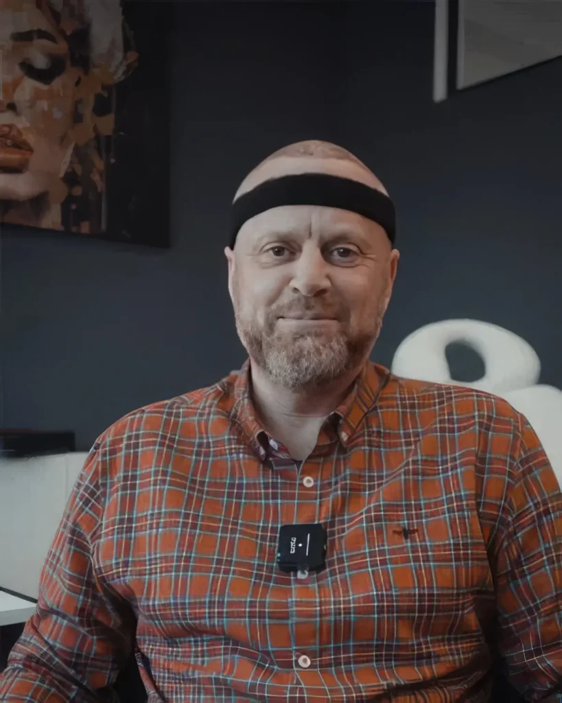 haartransplantation-startseite-sm-2-topaz-enhance-faceai