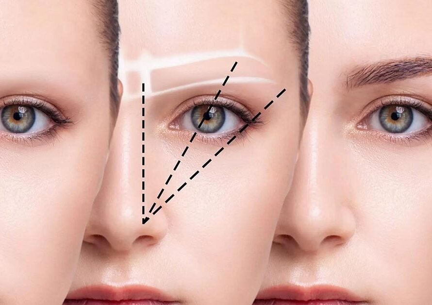 Augenbrauentransplantation