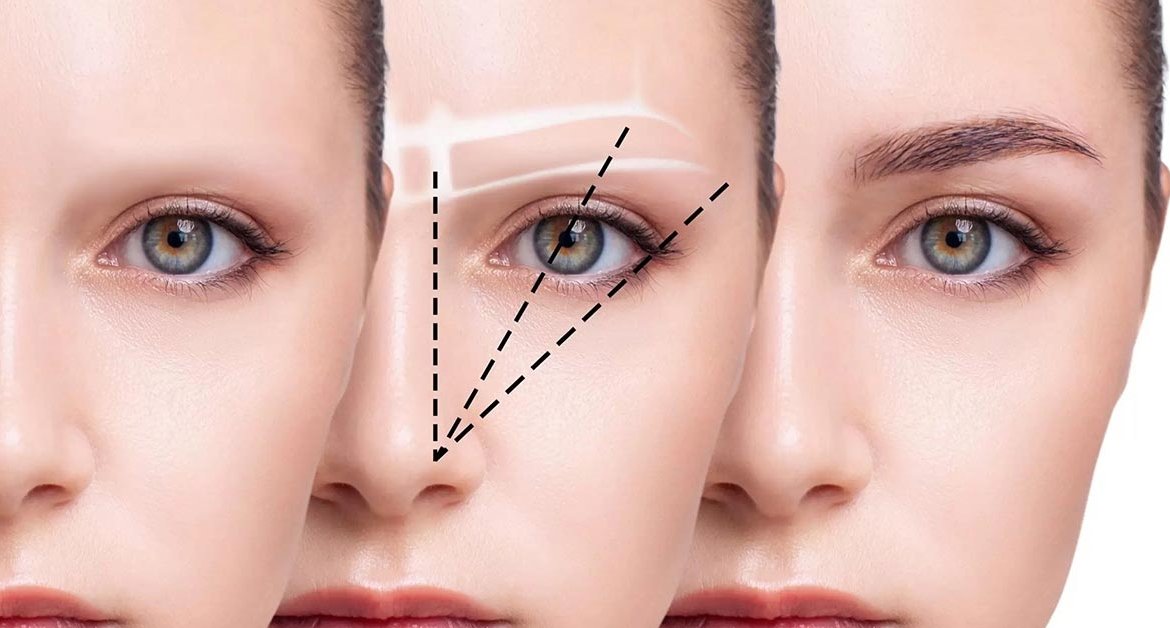 Augenbrauentransplantation