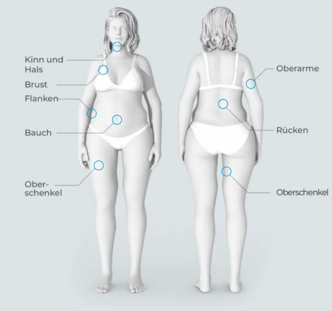 Kryolipolyse Hamburg CoolSculpting (1) (1)