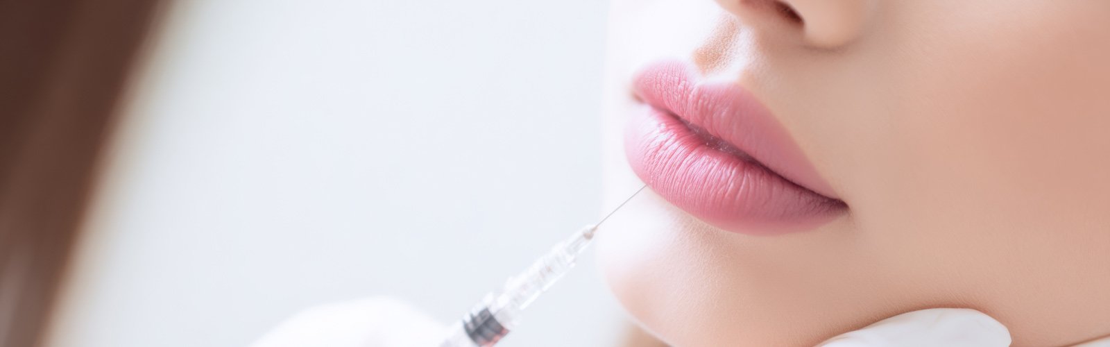 Lippenunterspritzung bei einer Frau in Hamburg